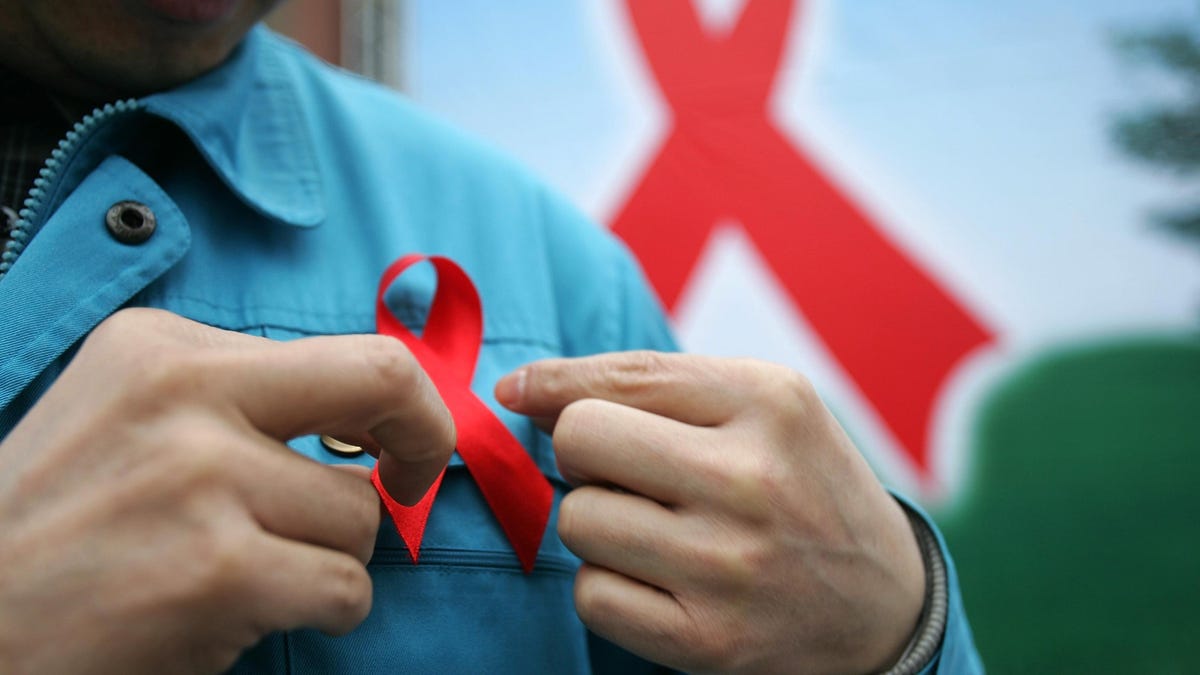 θεραπεια του ιου του aids